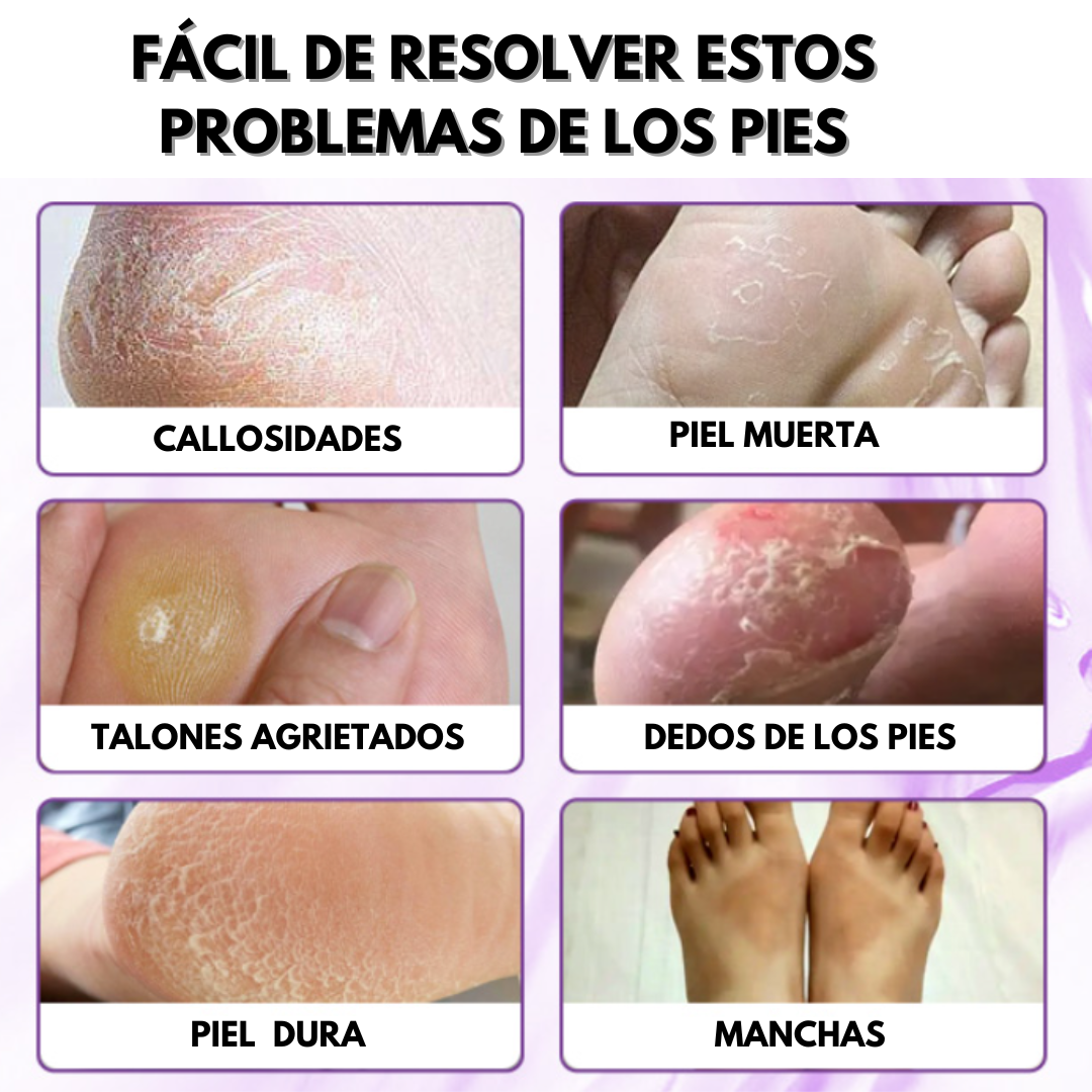 EXFOLIANTE PARA PIES