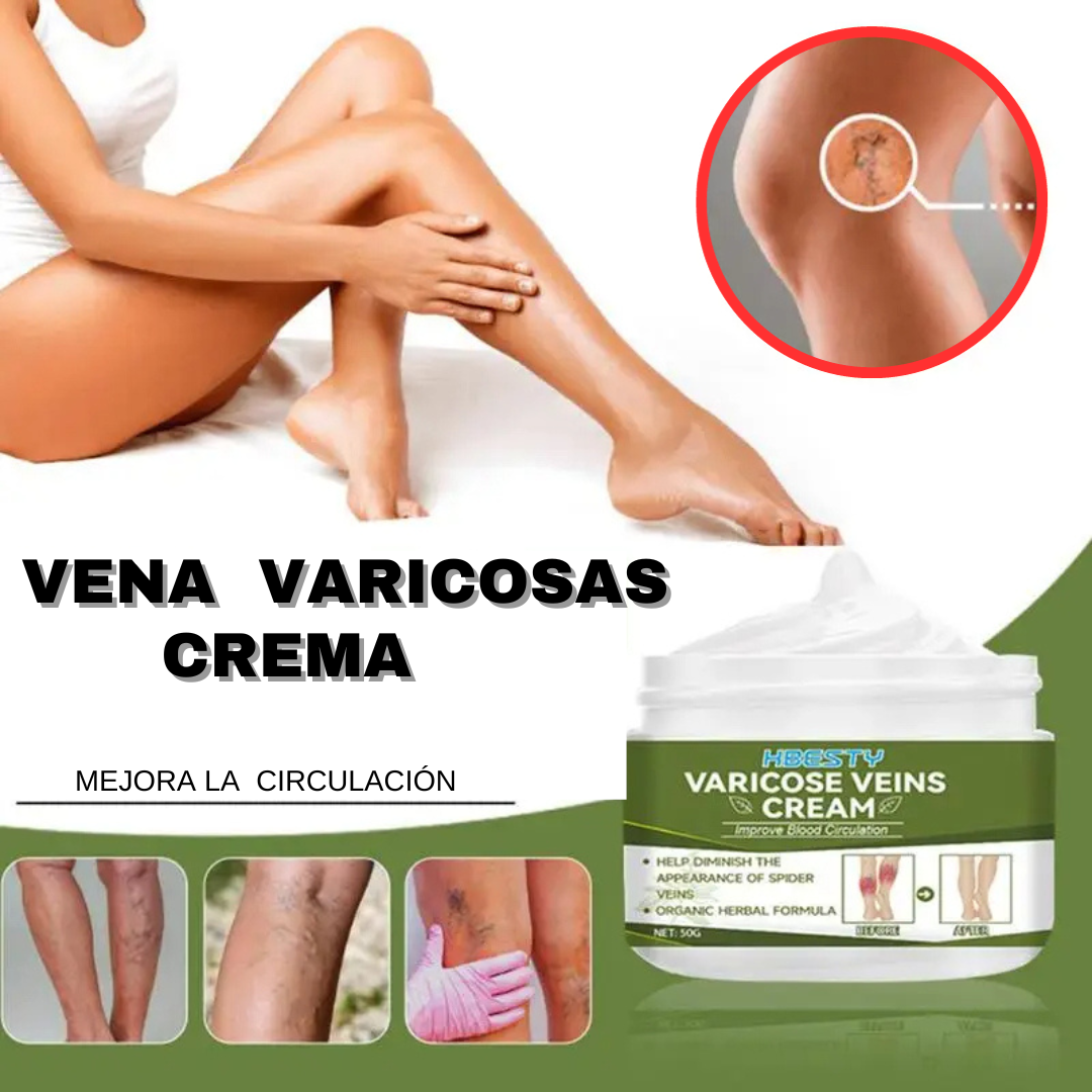 CREMA PARA VENAS VARICOSAS